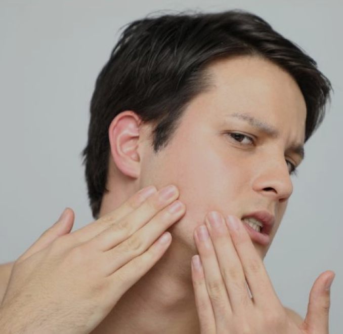 TMJ Causes 1 cau1 TMJ Expert LA
